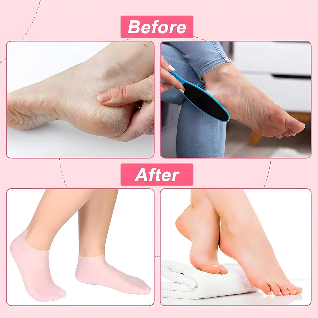 Hydrating Silicone Gel Spa Socks | Moisturizing Heel Repair Socks with Natural Oils, Aloe & Vitamin E | Anti-Slip Cracked Heel Socks for Dry Feet | Pedicure Spa Softening Socks For Men & Women