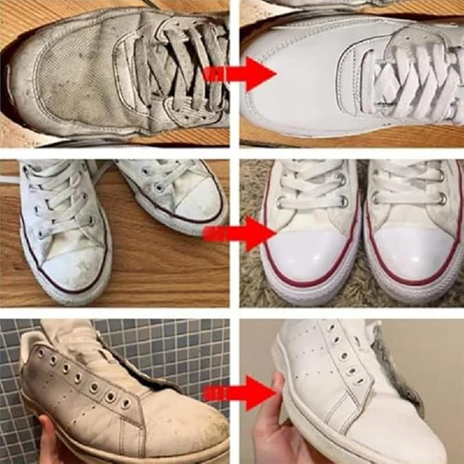 Yellow Stain Remover for Shoes, Shoes Whitening Cleaner, Shoe Cleaning Kit Whitening Cleansing Gel | Leather Scratch Cleaner